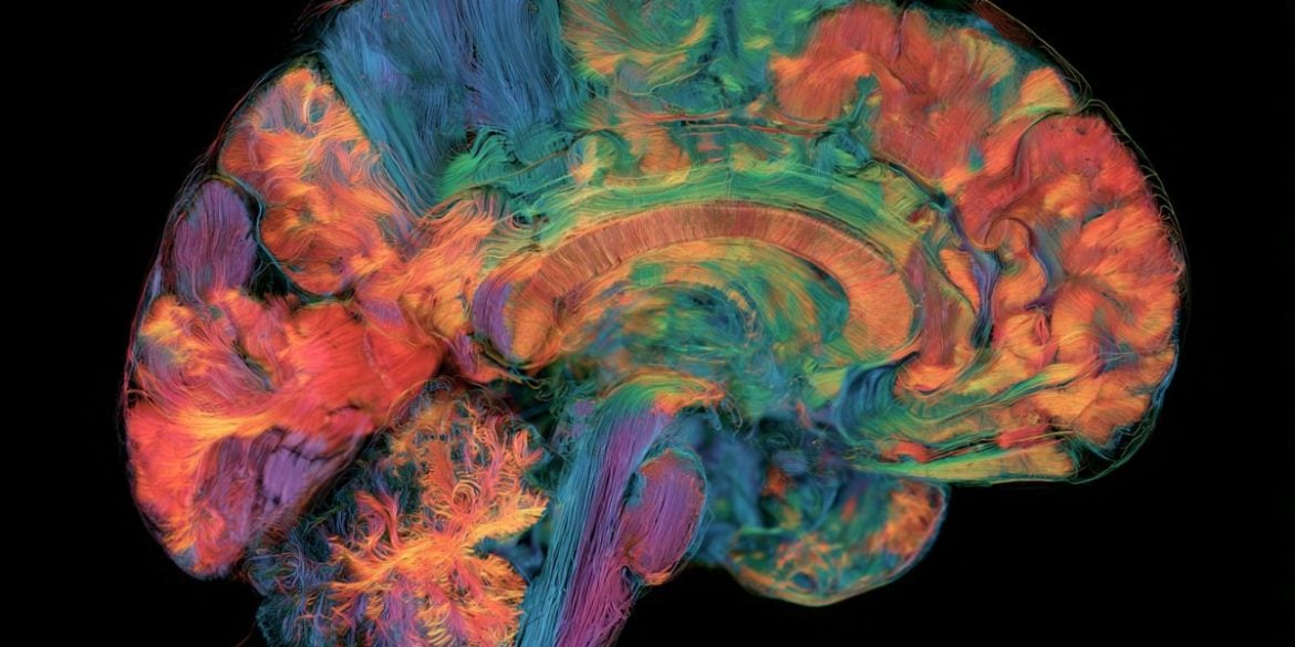 This shows a brain map.
