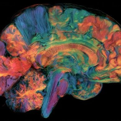 This shows a brain map.