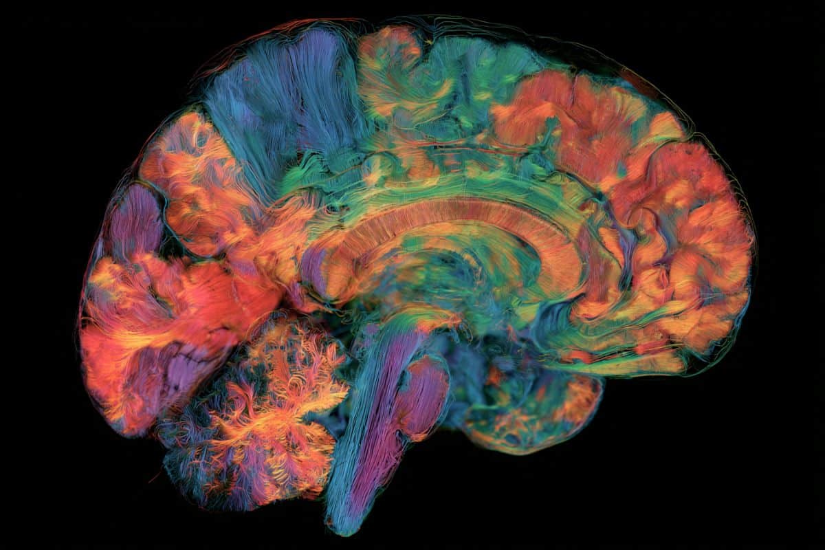This shows a brain map.