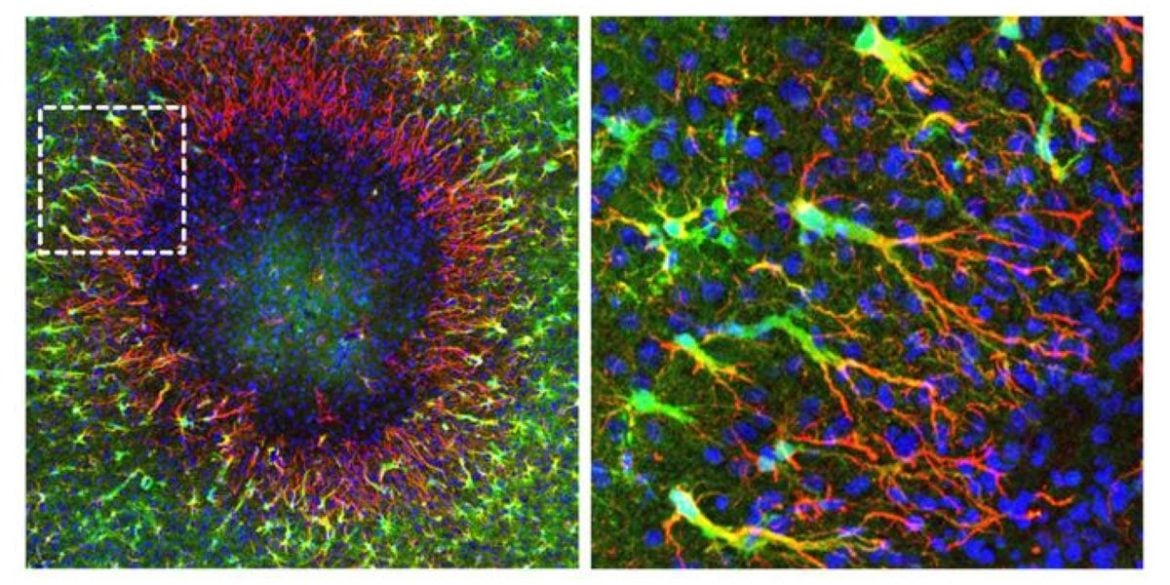 This shows the astrocytes repairing damaged tissue in the brain.