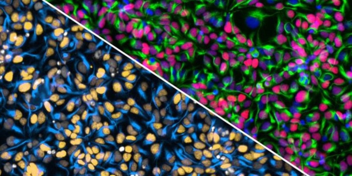 This shows neural progenitor stem cells.
