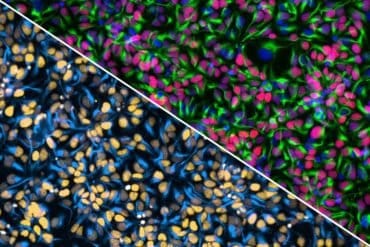 This shows neural progenitor stem cells.