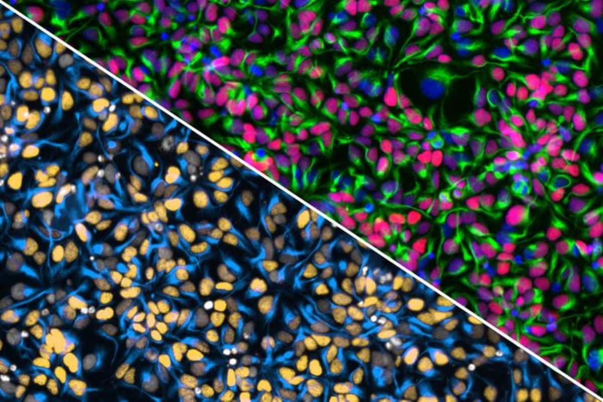 Cell Village" Platform Uncovers Genetic Drivers of Brain Growth