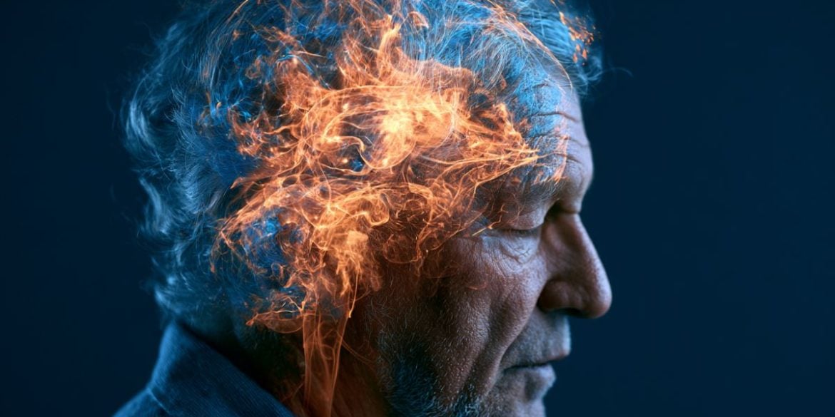 This shows a man and a brain.