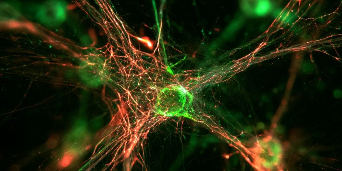 This shows neurons.