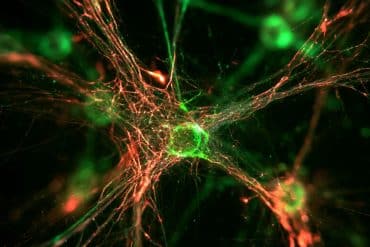 This shows neurons.