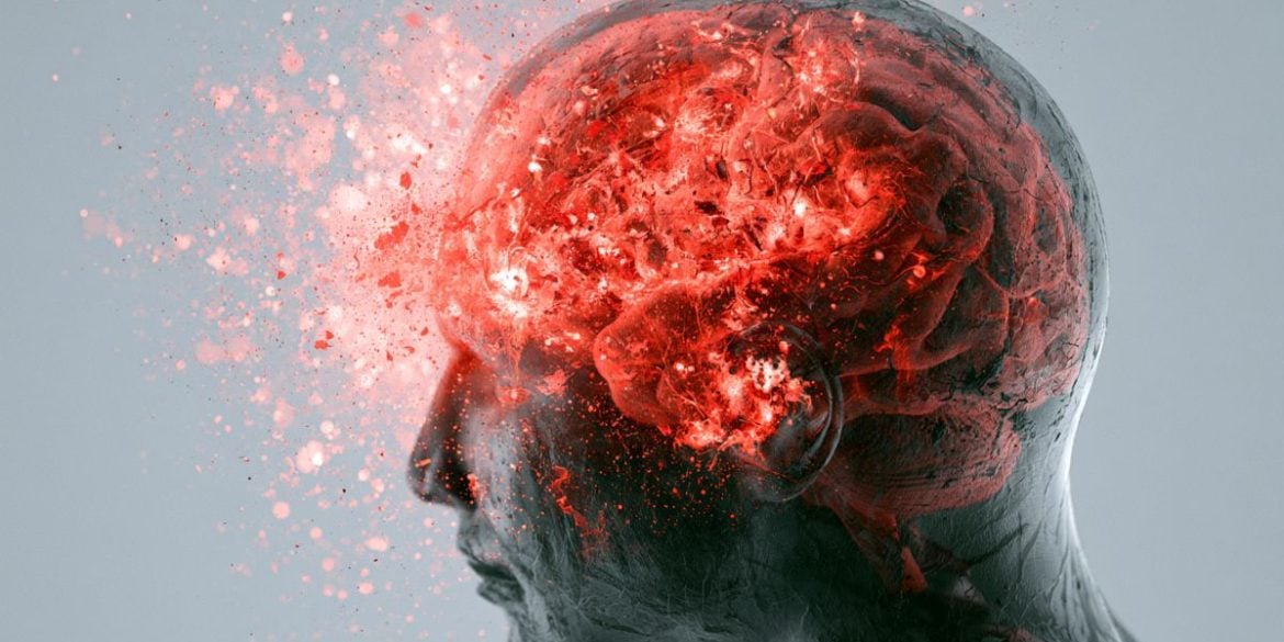 This shows a head and a brain.