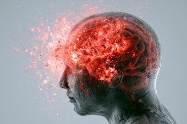 This shows a head and a brain.