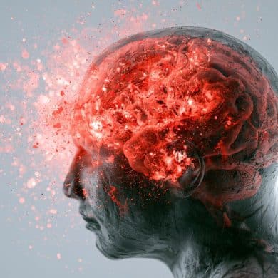 This shows a head and a brain.