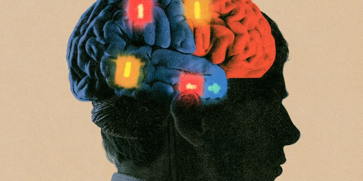 This shows a brain covered in switches.