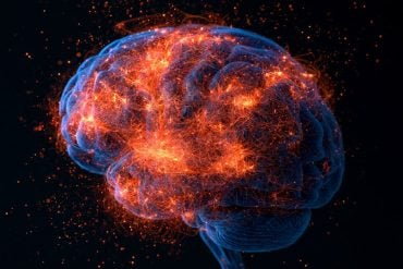 This shows a brain.
