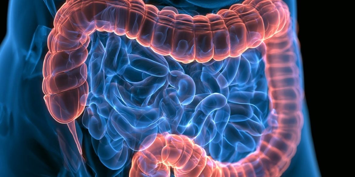 This shows an image of the intestines.