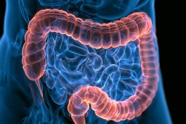 This shows an image of the intestines.