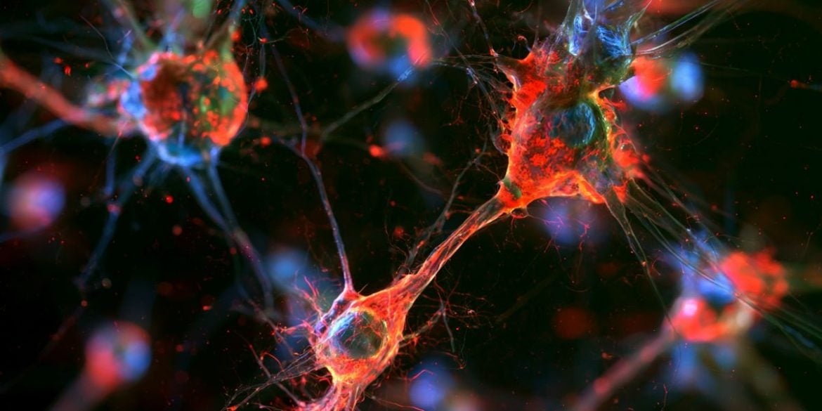 This shows microglia.