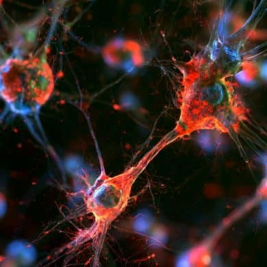 This shows microglia.