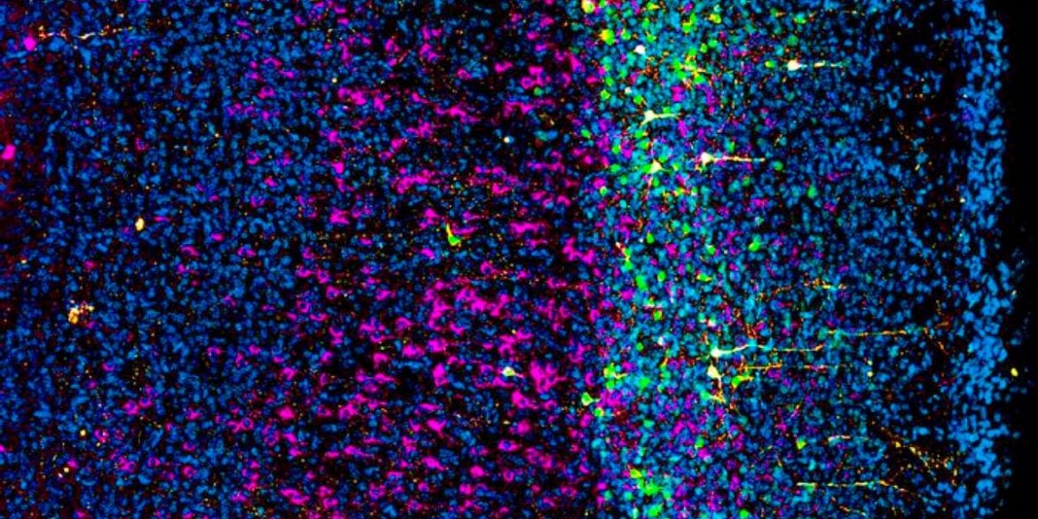 This shows neural stem cells in the cerebral cortex.