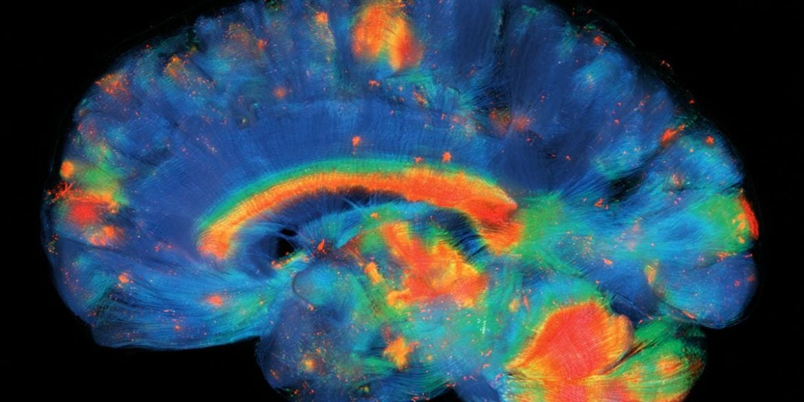 This shows a brain.