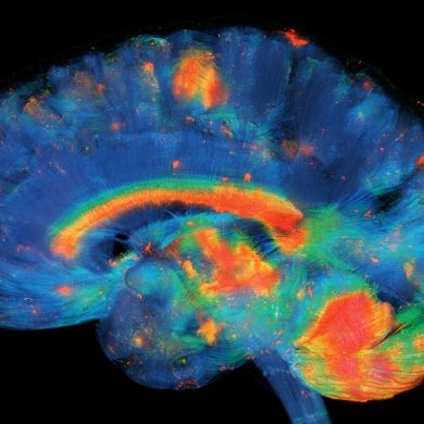 This shows a brain.