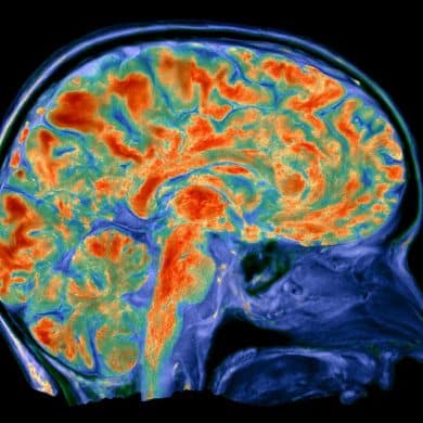 This shows a PET scan.