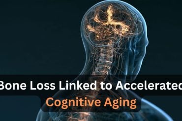 This shows the outline of a person and a brain. Caption reads "Bone Loss Linked to Accelerated Cognitive Aging."