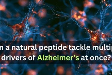 This shows neurons. Caption reads "Can a natural peptide tackle multiple drivers of Alzheimer’s at once?"