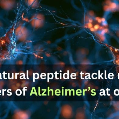 This shows neurons. Caption reads "Can a natural peptide tackle multiple drivers of Alzheimer’s at once?"