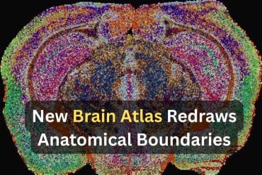 This shows a cross section of a mouse brain. Caption reads "New Brain Atlas Redraws Anatomical Boundaries."