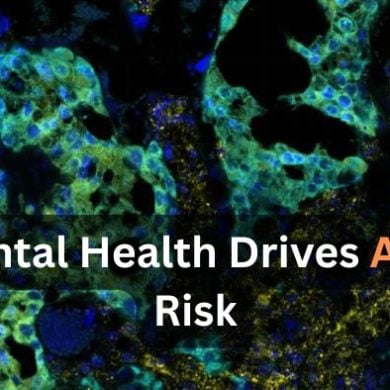 This shows placental cells. Caption reads "Placental health drives autism risk."