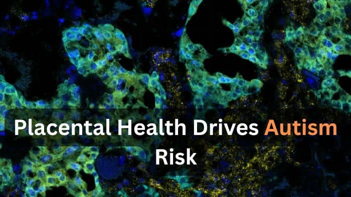 The Placenta May Decide Autism Vulnerability