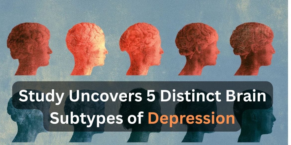 This shows statue like heads. Caption reads "tudy Uncovers 5 Distinct Brain Subtypes of Depression".