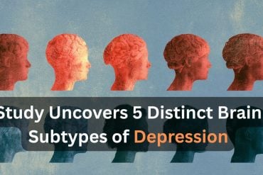 This shows statue like heads. Caption reads "tudy Uncovers 5 Distinct Brain Subtypes of Depression".