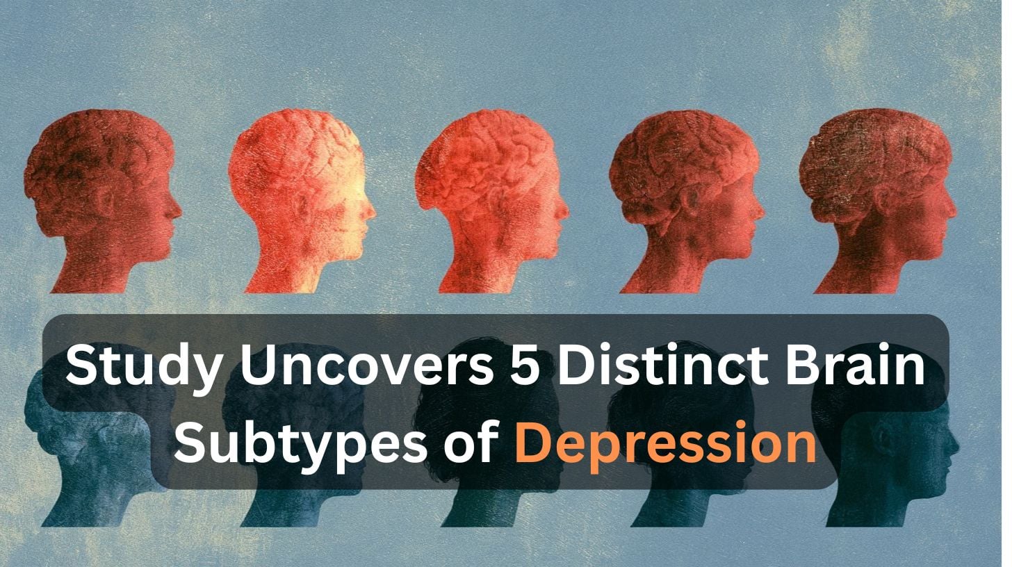 This shows statue like heads. Caption reads "tudy Uncovers 5 Distinct Brain Subtypes of Depression".