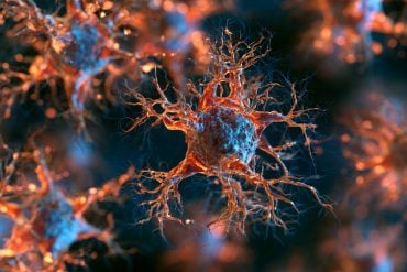 This shows neurons.