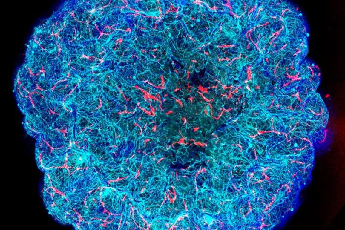 APOE4 Damages Brain Vessels and Halts Waste Disposal