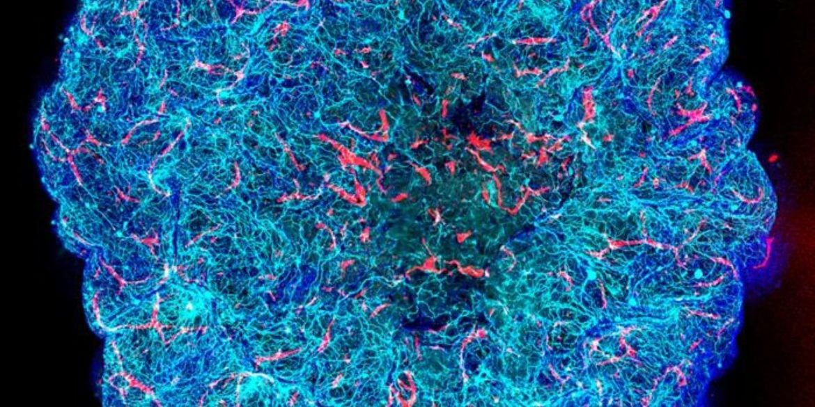 This shows the vascular architecture of the miBRAIN.