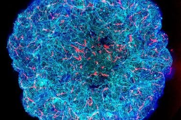 This shows the vascular architecture of the miBRAIN.