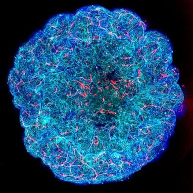 This shows the vascular architecture of the miBRAIN.