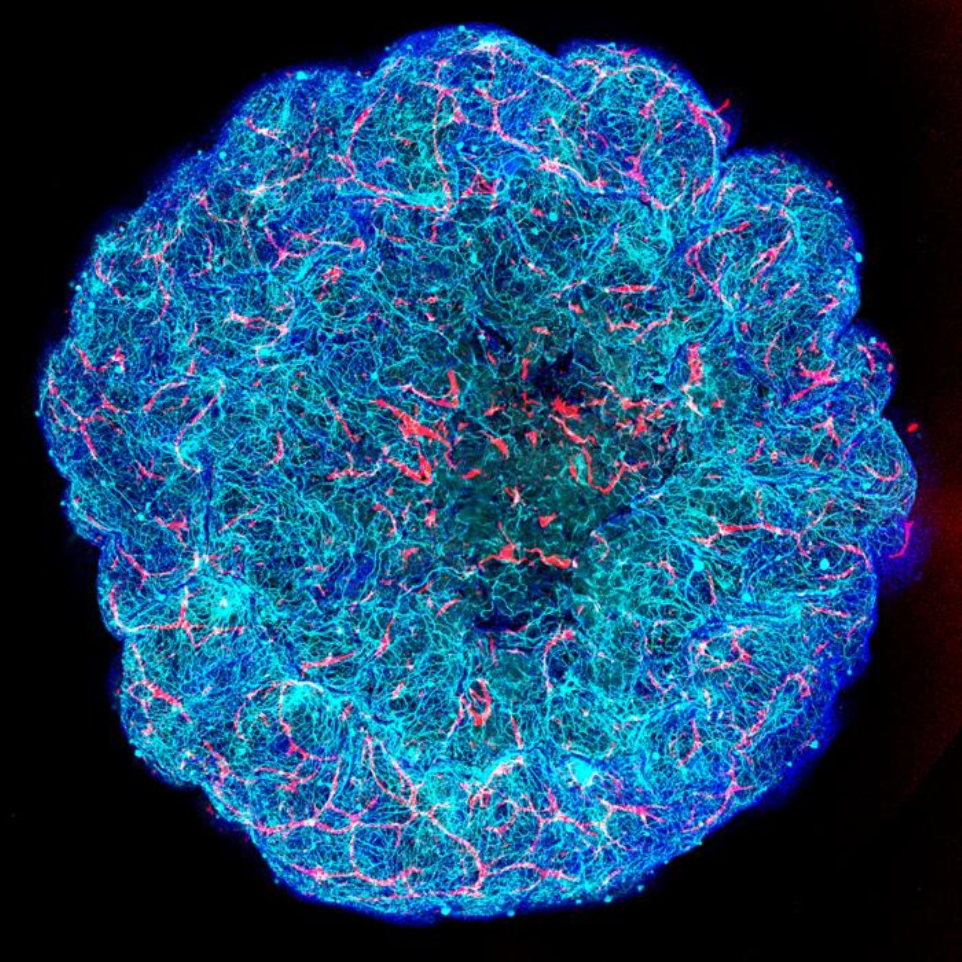 Photograph: neurosciencenews.com