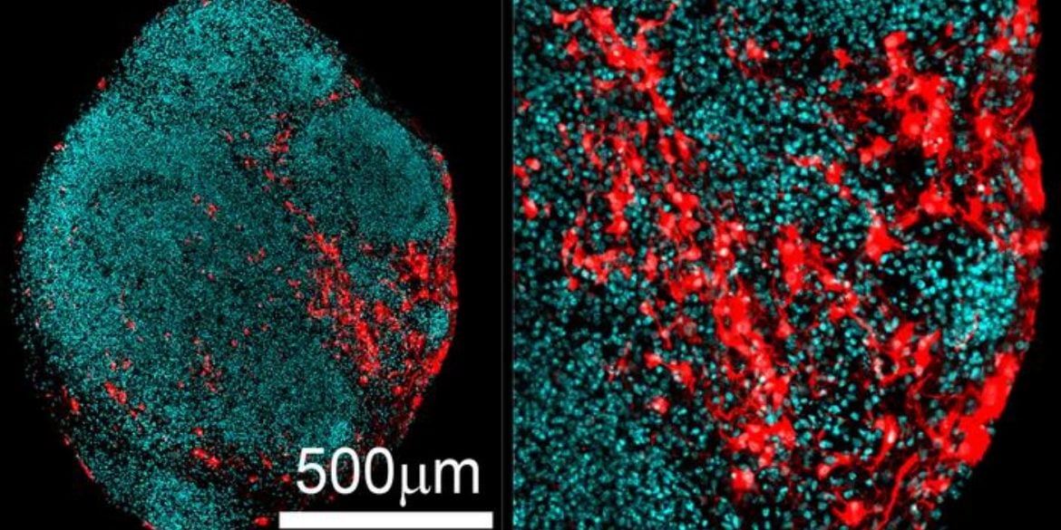 This shows neurons generated in the brain organoid.