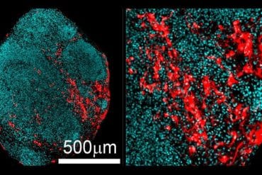 This shows neurons generated in the brain organoid.