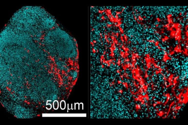This shows neurons generated in the brain organoid.