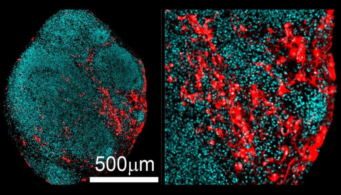 Photograph accompanying Brain organoids grown for a year caught TSC2 astrocytes emerging already inflamed