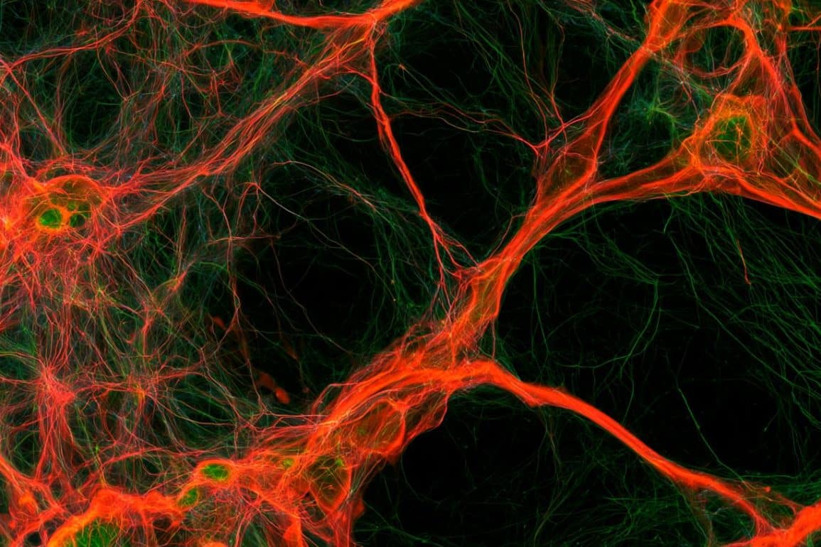 Brain Cells Measure Axons to Build the Perfect Myelin Sheath
