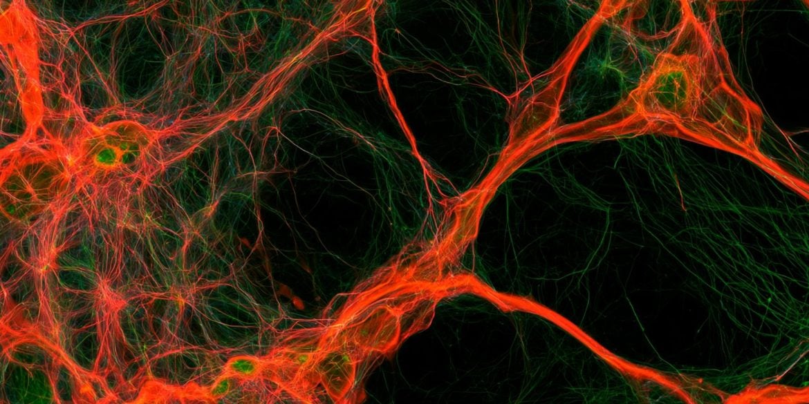 This shows neurons.