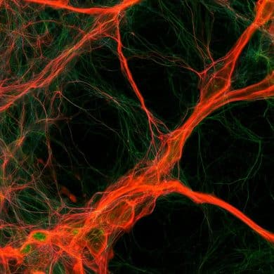 This shows neurons.