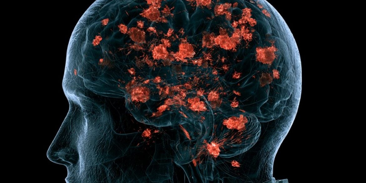 This shows a brain and red "proteins".