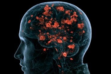 This shows a brain and red "proteins".
