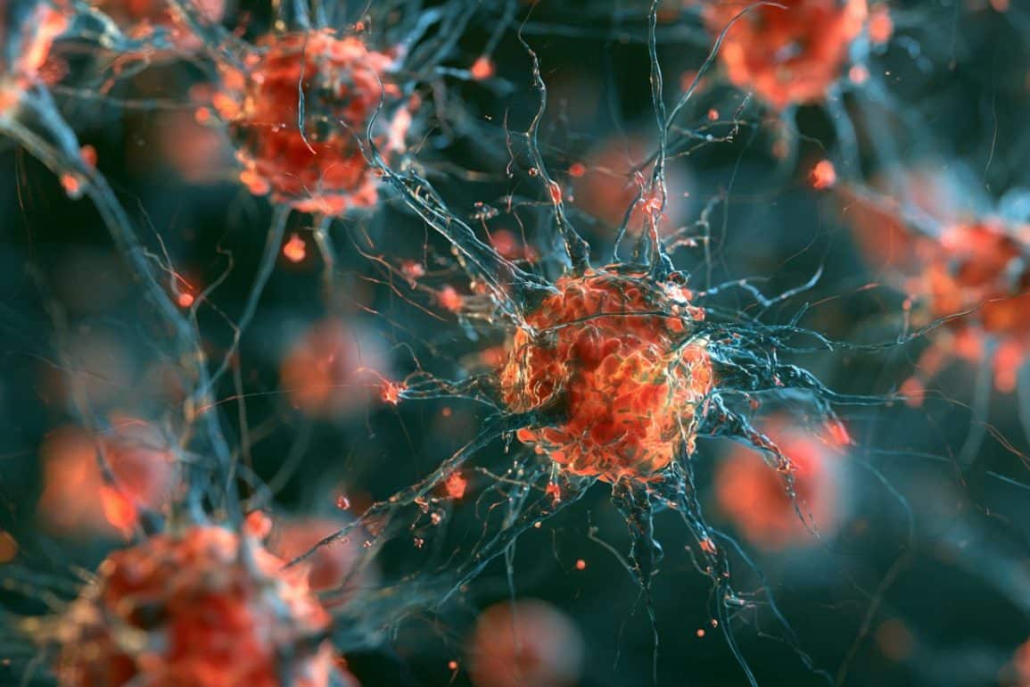Common Viral Infections Accelerate ALS Progression