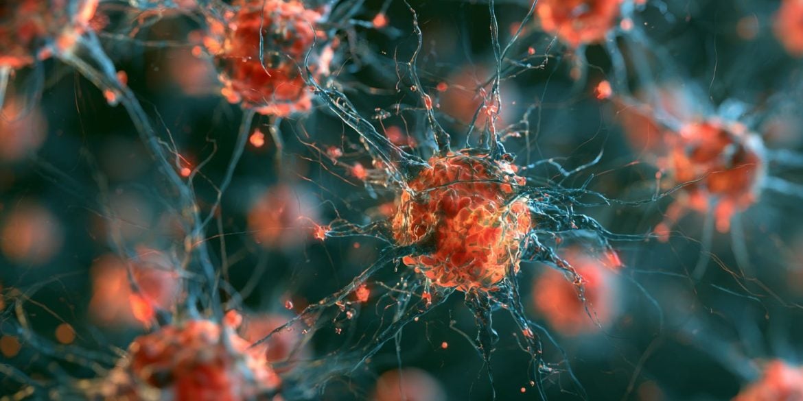 This shows neurons.