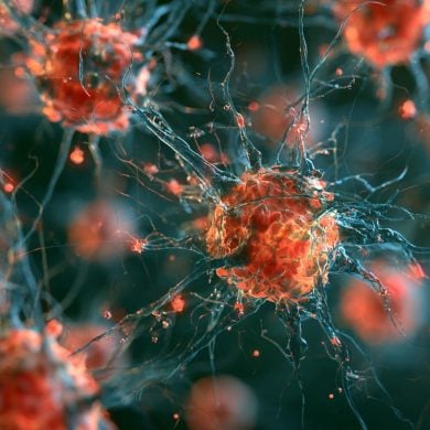 This shows neurons.